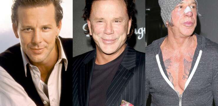 Chirurgie esthétique : Mickey Rourke, une nouvelle fois, embarqué !