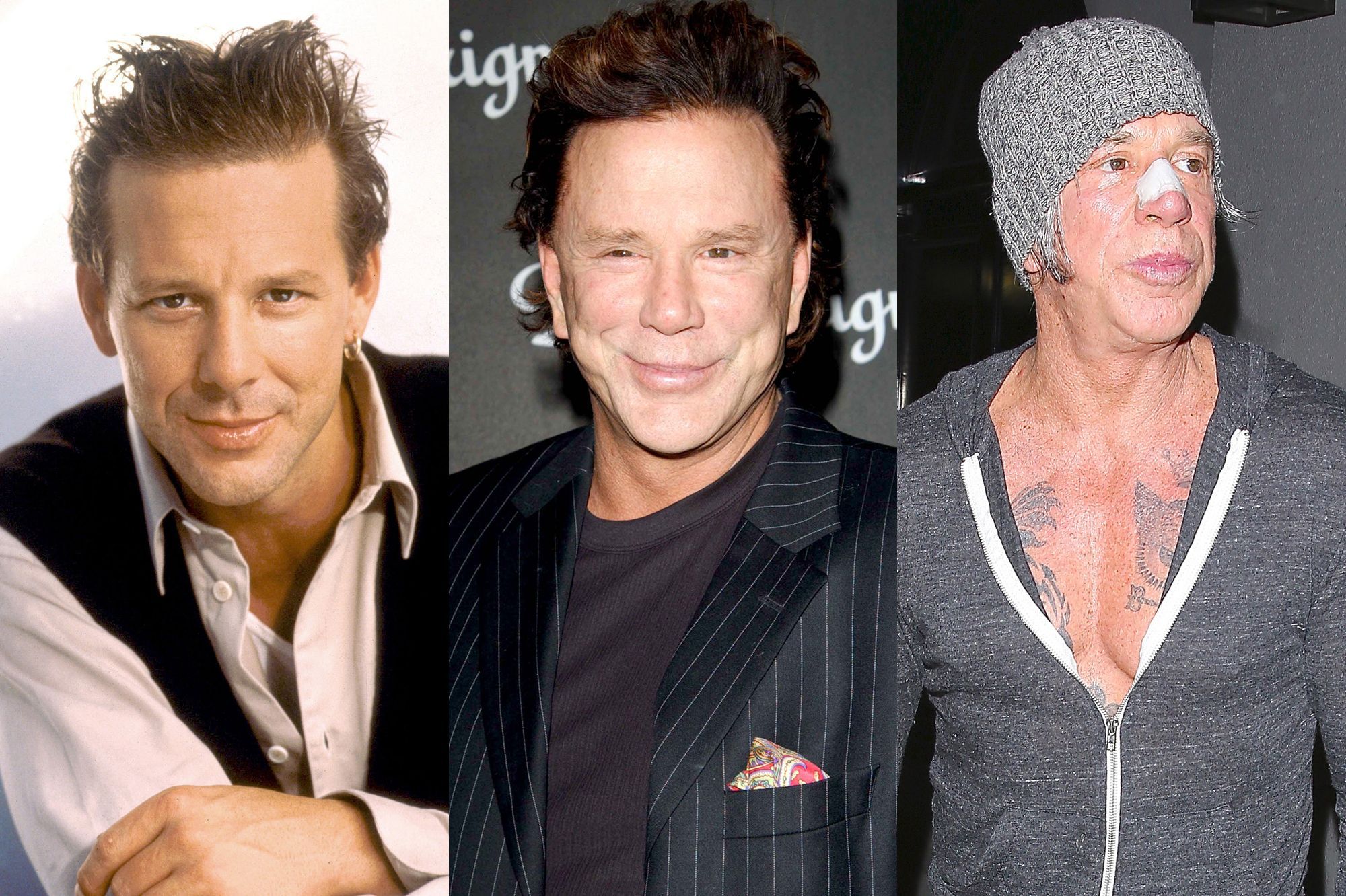 Chirurgie esthétique : Mickey Rourke, une nouvelle fois, embarqué !