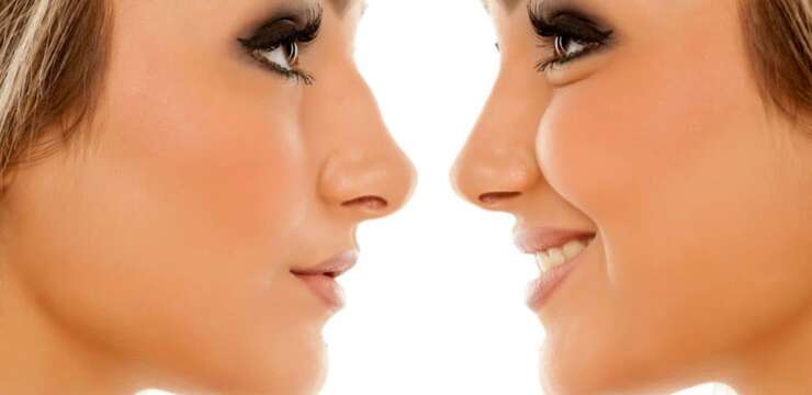 chirurgie reparatrice du nez rhinoplastie