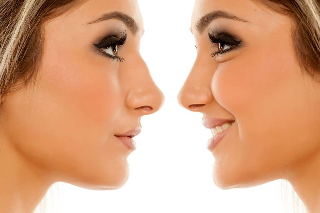 chirurgie reparatrice du nez rhinoplastie