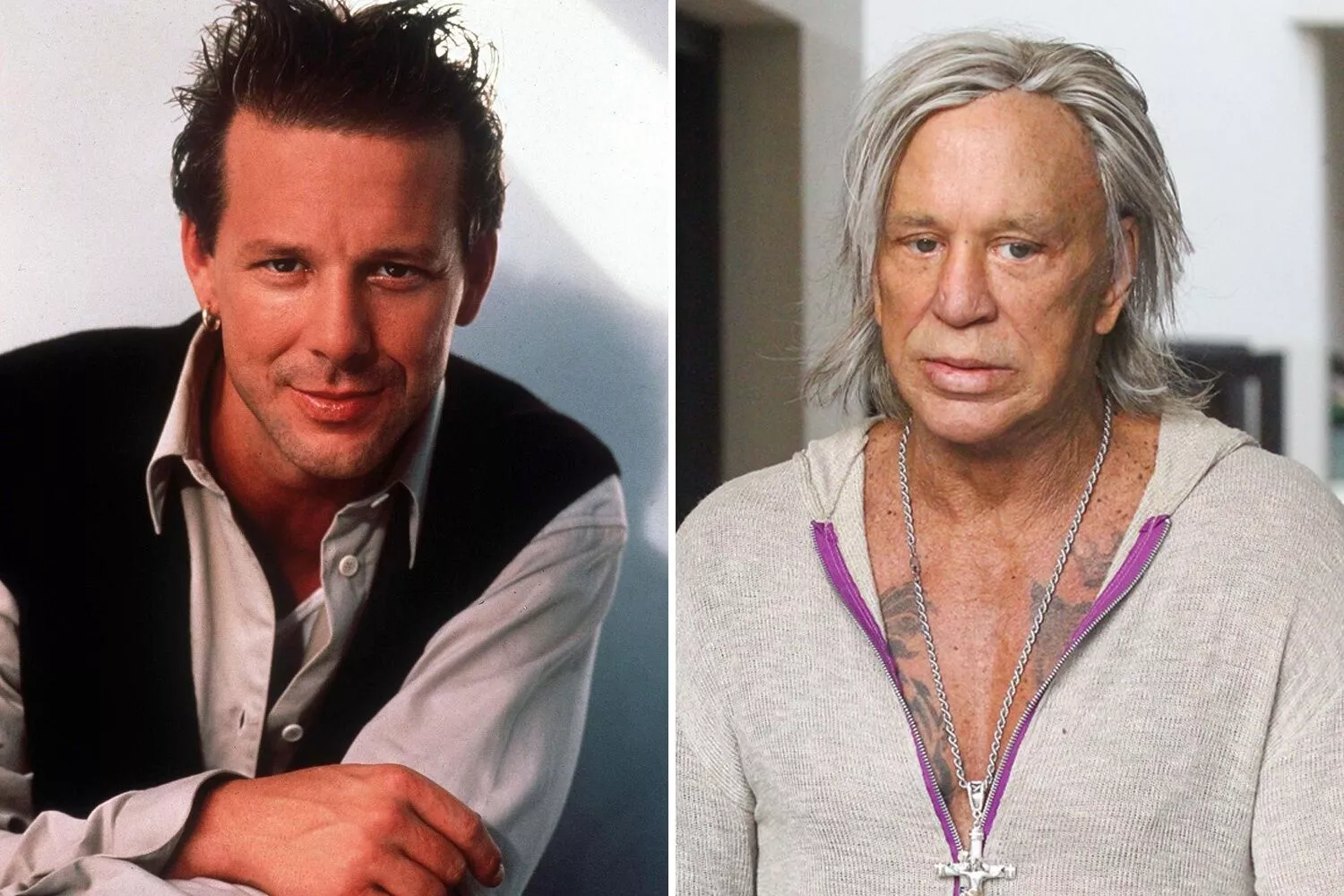 Chirurgie esthétique : Mickey Rourke, une nouvelle fois, embarqué !