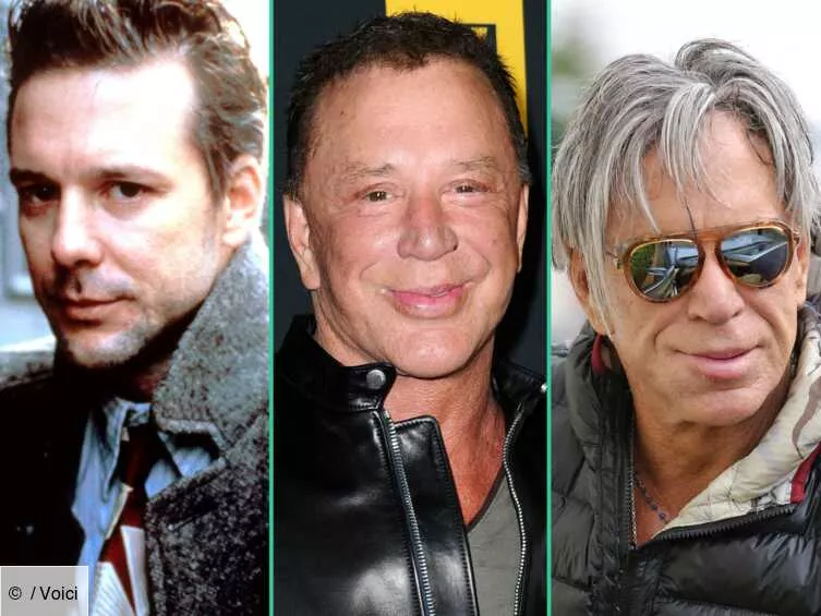 Chirurgie esthétique : Mickey Rourke, une nouvelle fois, embarqué !