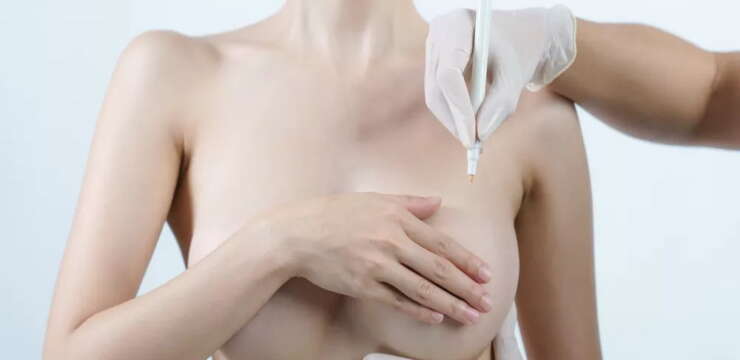 chirurgie esthétique de réduction mammaire