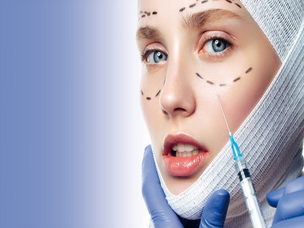 chirurgie esthetique