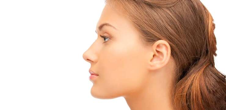 rhinoplastie