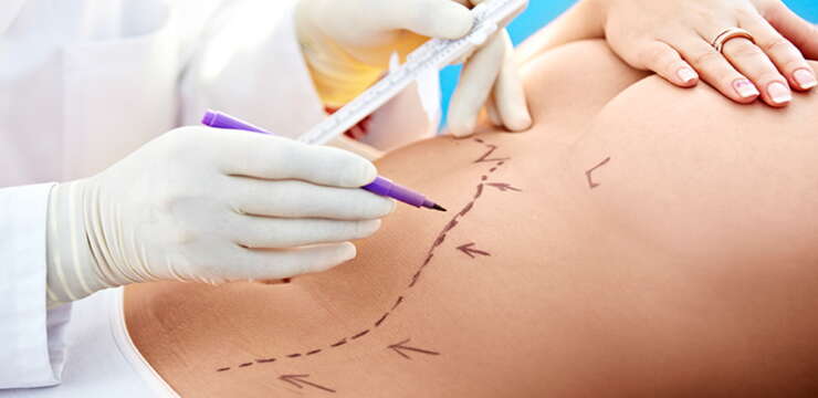 sutures en chirurgie esthétique