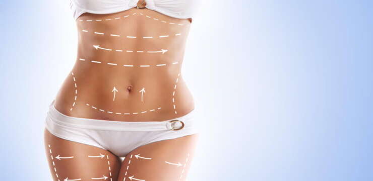 Lipoaspiration Tunisie