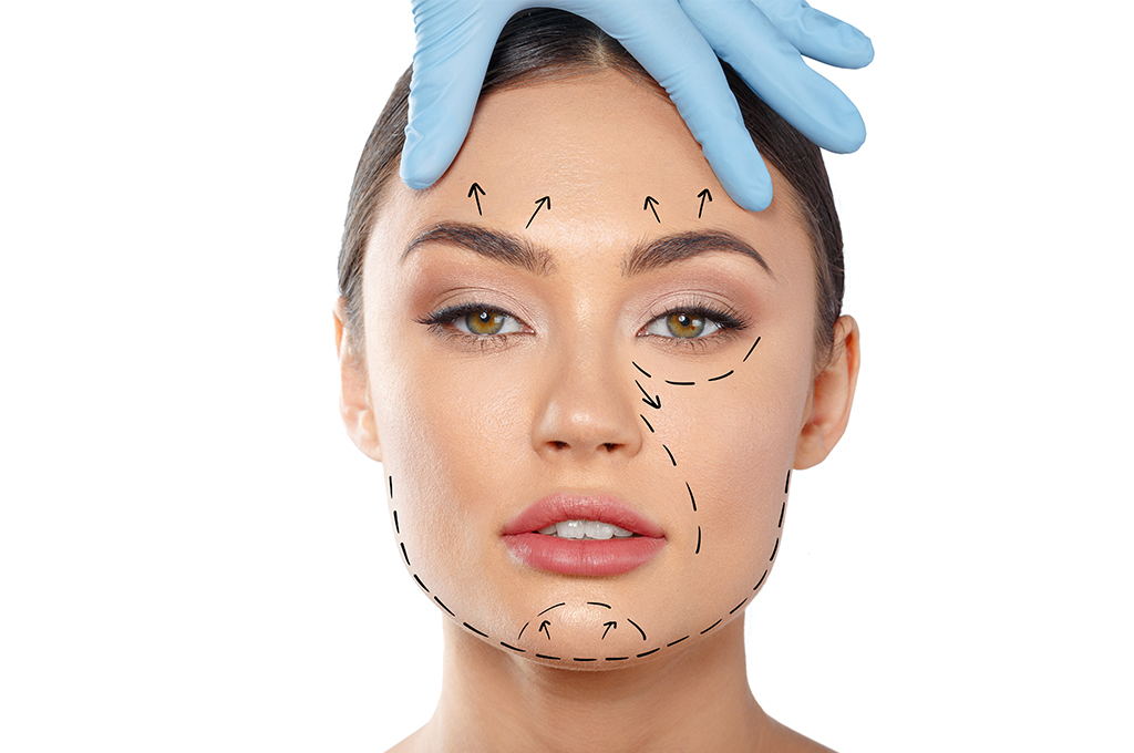 Chirurgie plastique du visage