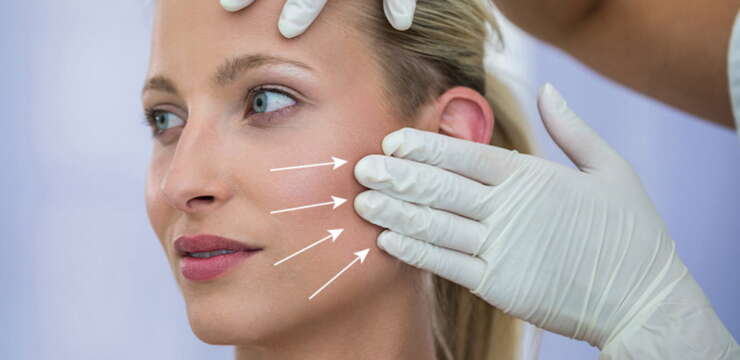 lifting cervico-facial