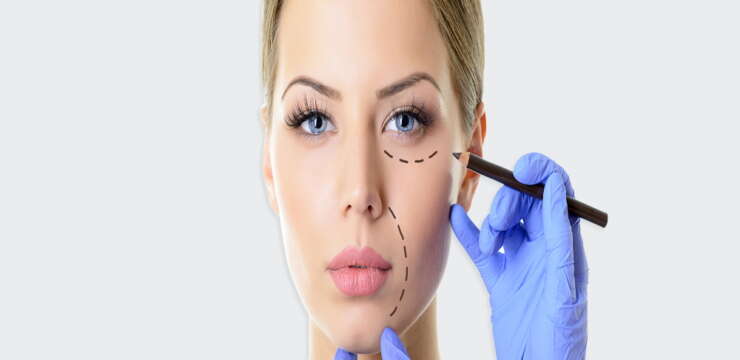 lipofilling du visage