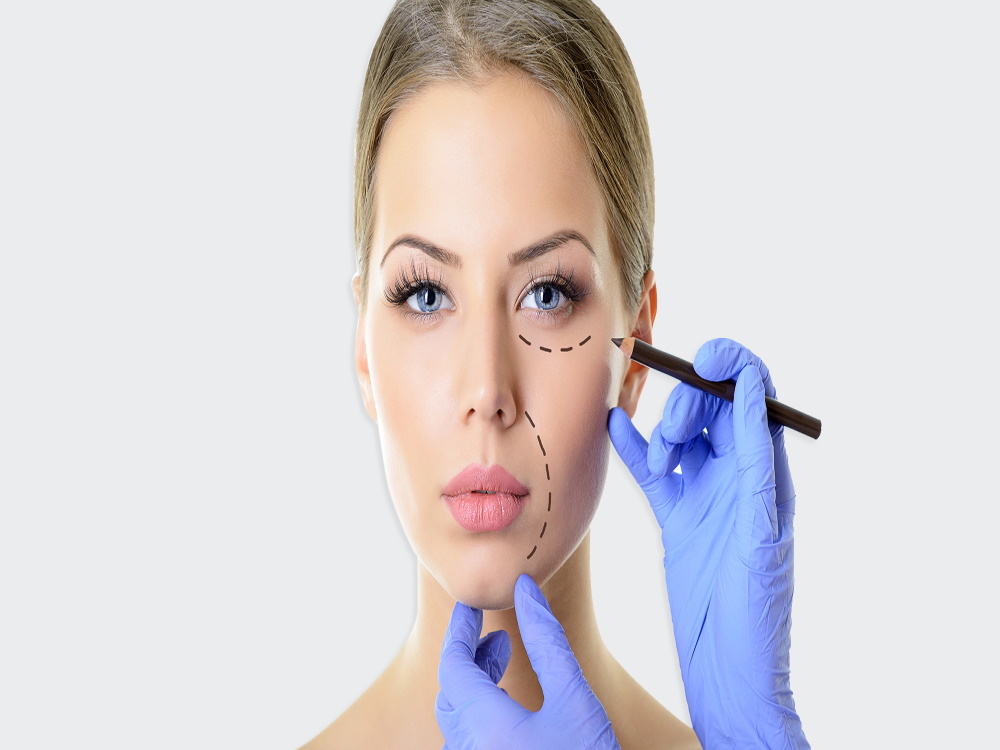 lipofilling du visage