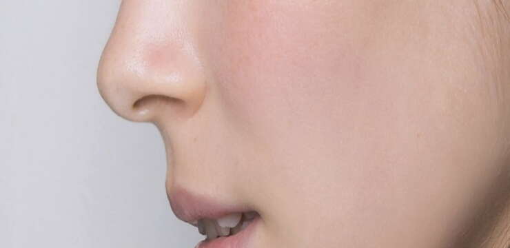 rhinoplastie fonctionnelle