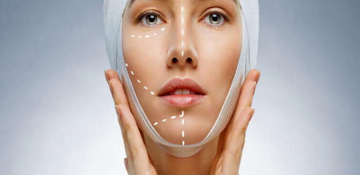 lifting cervico-facial