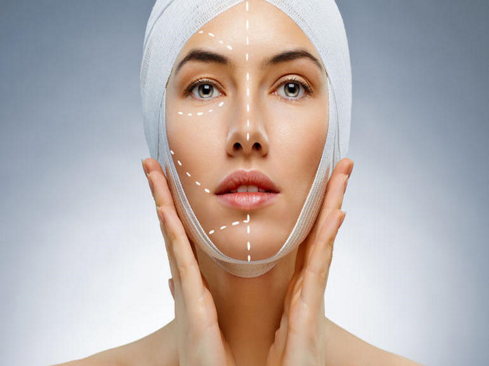 lifting cervico-facial