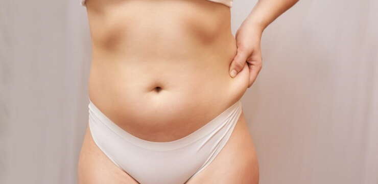 abdominoplastie